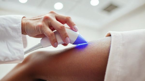 Guide pratique pour l'épilation laser sur peau noire sécurisée